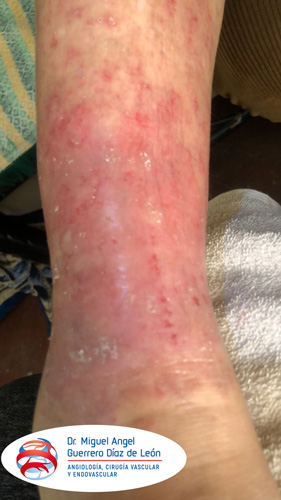 drmiguelangelguerrero_012