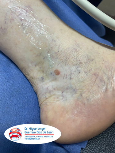 drmiguelangelguerrero_013