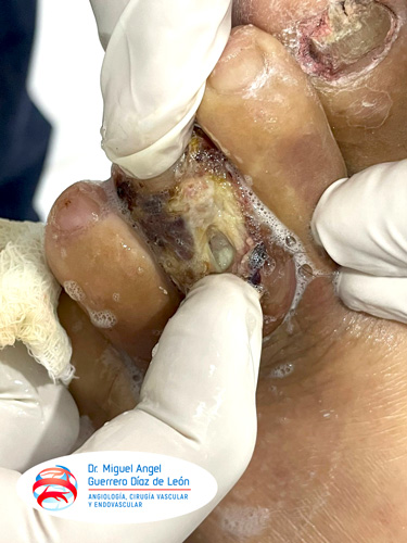 drmiguelangelguerrero_014