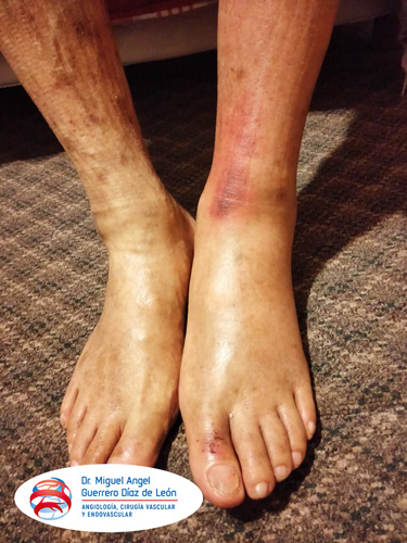 drmiguelangelguerrero_015