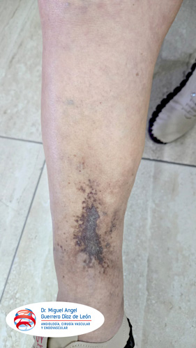 drmiguelangelguerrero_016