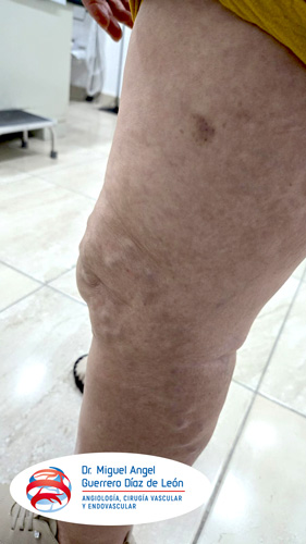 drmiguelangelguerrero_017