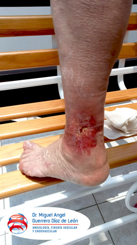 drmiguelangelguerrero_018